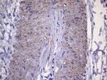 VEGFC Antibody in Immunohistochemistry (Paraffin) (IHC (P))