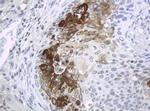 WFDC2 Antibody in Immunohistochemistry (Paraffin) (IHC (P))