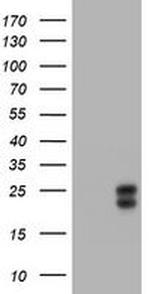 WFDC2 Antibody in Western Blot (WB)