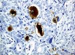 WFDC2 Antibody in Immunohistochemistry (Paraffin) (IHC (P))