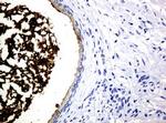 WFDC2 Antibody in Immunohistochemistry (Paraffin) (IHC (P))