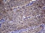 RRM1 Antibody in Immunohistochemistry (Paraffin) (IHC (P))