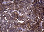 RRM1 Antibody in Immunohistochemistry (Paraffin) (IHC (P))