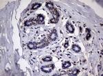 RRM1 Antibody in Immunohistochemistry (Paraffin) (IHC (P))