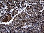 RASGRP3 Antibody in Immunohistochemistry (Paraffin) (IHC (P))