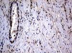 RASGRP3 Antibody in Immunohistochemistry (Paraffin) (IHC (P))