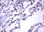 RASGRP3 Antibody in Immunohistochemistry (Paraffin) (IHC (P))