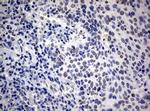 RASGRP3 Antibody in Immunohistochemistry (Paraffin) (IHC (P))