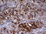 RASGRP3 Antibody in Immunohistochemistry (Paraffin) (IHC (P))