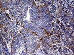 RASGRP3 Antibody in Immunohistochemistry (Paraffin) (IHC (P))