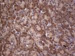 Dicer Antibody in Immunohistochemistry (Paraffin) (IHC (P))