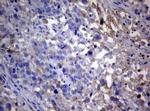 PIK3C2A Antibody in Immunohistochemistry (Paraffin) (IHC (P))