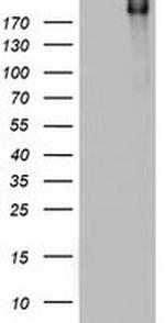 DOCK8 Antibody in Western Blot (WB)