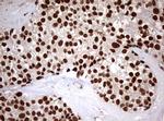 USP44 Antibody in Immunohistochemistry (Paraffin) (IHC (P))