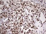 USP44 Antibody in Immunohistochemistry (Paraffin) (IHC (P))