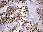 USP44 Antibody in Immunohistochemistry (Paraffin) (IHC (P))