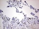 ZEB2 Antibody in Immunohistochemistry (Paraffin) (IHC (P))