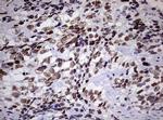 ZEB2 Antibody in Immunohistochemistry (Paraffin) (IHC (P))