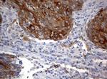 BNIP1 Antibody in Immunohistochemistry (Paraffin) (IHC (P))