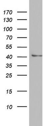 ASL Antibody in Western Blot (WB)