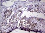 NDUFS2 Antibody in Immunohistochemistry (Paraffin) (IHC (P))