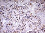 NDUFS2 Antibody in Immunohistochemistry (Paraffin) (IHC (P))