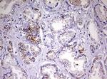 NDUFS2 Antibody in Immunohistochemistry (Paraffin) (IHC (P))