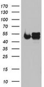 NDUFS2 Antibody in Western Blot (WB)