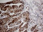 NDUFS2 Antibody in Immunohistochemistry (Paraffin) (IHC (P))