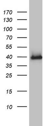 HMBS Antibody in Western Blot (WB)