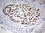 PARN Antibody in Immunohistochemistry (Paraffin) (IHC (P))