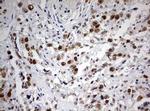 PARN Antibody in Immunohistochemistry (Paraffin) (IHC (P))