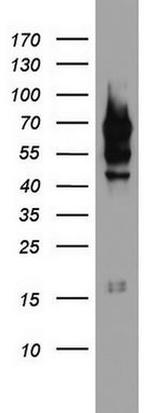 PARN Antibody in Western Blot (WB)