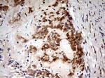 HMBS Antibody in Immunohistochemistry (Paraffin) (IHC (P))