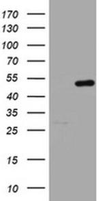 HMBS Antibody in Western Blot (WB)