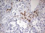 DOCK2 Antibody in Immunohistochemistry (Paraffin) (IHC (P))