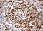 DOCK2 Antibody in Immunohistochemistry (Paraffin) (IHC (P))