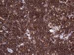 DOCK2 Antibody in Immunohistochemistry (Paraffin) (IHC (P))