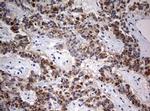 FEN1 Antibody in Immunohistochemistry (Paraffin) (IHC (P))