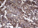 OAS2 Antibody in Immunohistochemistry (Paraffin) (IHC (P))