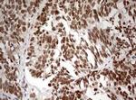 TRIM24 Antibody in Immunohistochemistry (Paraffin) (IHC (P))