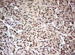 TRIM24 Antibody in Immunohistochemistry (Paraffin) (IHC (P))