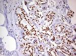 DDX56 Antibody in Immunohistochemistry (Paraffin) (IHC (P))