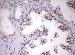 DDX56 Antibody in Immunohistochemistry (Paraffin) (IHC (P))