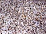 DDX56 Antibody in Immunohistochemistry (Paraffin) (IHC (P))