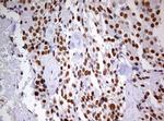 DDX56 Antibody in Immunohistochemistry (Paraffin) (IHC (P))