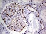 DDX56 Antibody in Immunohistochemistry (Paraffin) (IHC (P))