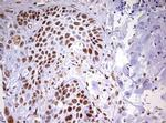 DDX56 Antibody in Immunohistochemistry (Paraffin) (IHC (P))