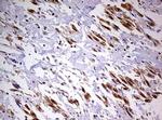 DDX56 Antibody in Immunohistochemistry (Paraffin) (IHC (P))