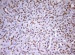 DDX56 Antibody in Immunohistochemistry (Paraffin) (IHC (P))